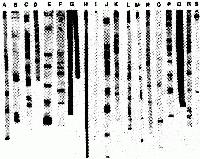Les tests officiels ont t trs critiqus. Comparaison de 19 tests Western Blott par diffrents laboratoires avec le mme chantillon de sang.
